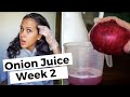 ONION JUICE UPDATE week 2