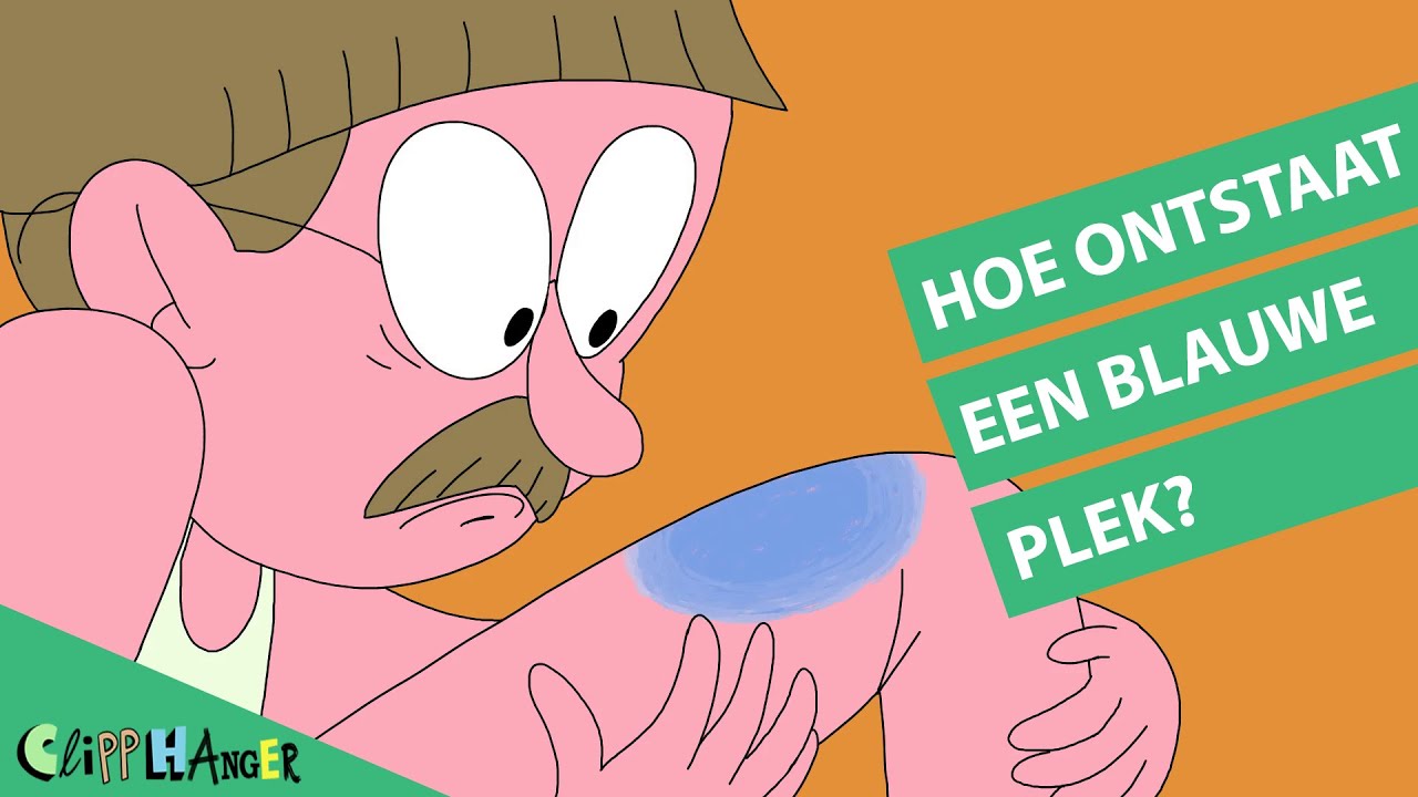 Hoe ontstaat een blauwe plek? - YouTube