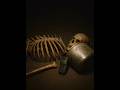 Hyderabad Skeleton Mystery рџ Ї Hyderabad Skeleton Mystery рџ Ї