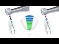 VDW Dental · How To: VDW.ROTATE - Step by step