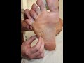 Muscle Palpation - Abductor Digiti Minimi Pedis [1st Layer of Intrinsic Foot Muscle] [ASMR]