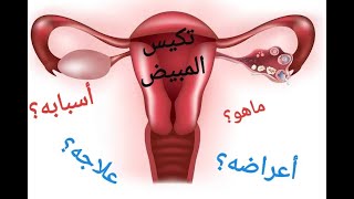 عالجت تكيس المبايض فحملت بتوأم بعد ستة سنوات