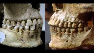 This Will Help Increase Your Bone Structure