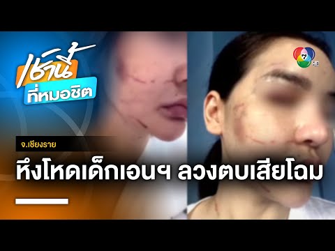 หึงโหด ! สาวแค้นเด็กเอนฯ ติดพันแฟนหนุ่ม ลวงกระทืบจนเสียโฉม จ.เชียงราย