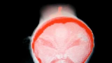 VTK Head Visualization 5