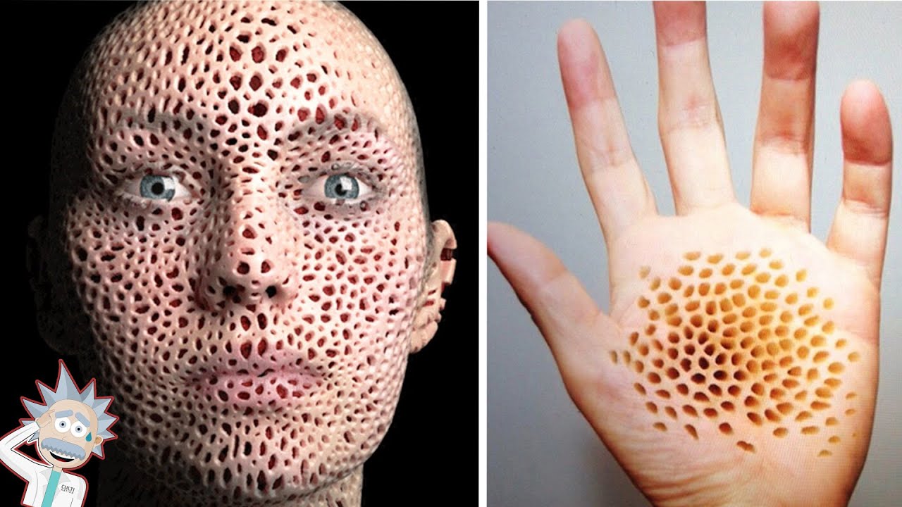 Les 10 Phobies Animales Les Plus Courantes