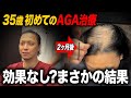 【AGA治療2ヶ月目】ミノタブの副作用?抜け毛の増加と体毛の濃さに悩む35歳の本音。