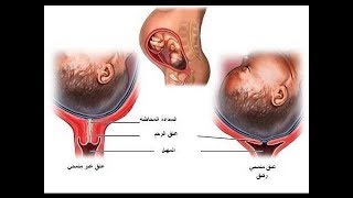 علامات انفتاح الرحم في الشهر التاسع - عوارض تدل على فتح عنق الرحم