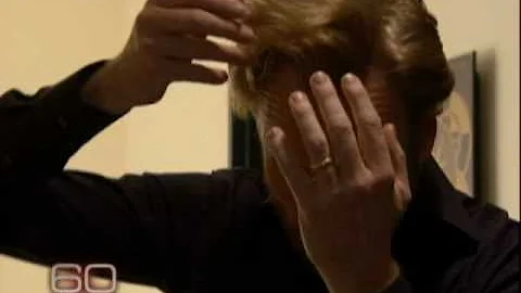 Extra: What's With Conan O'Brien's Hair?