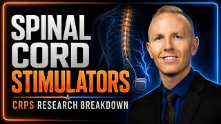 Spinal Cord and DRG Stimulators | CRPS Research Breakdown