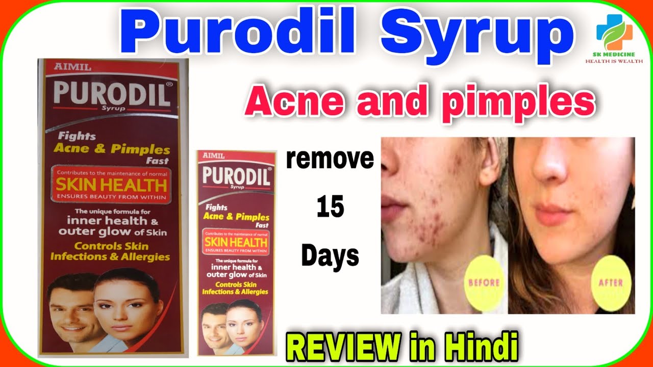 PURODIL SYRUP REVIEW Acne&Pimples skin infection Allergies outer