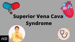 Superior Vena Cava syndrome, Causes, Signs and Symptoms, Diagnosis and Treatment.