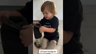Brave Little Heros First Steps double Amputee Child Walking With Prosthetic Legs Emotional Journey