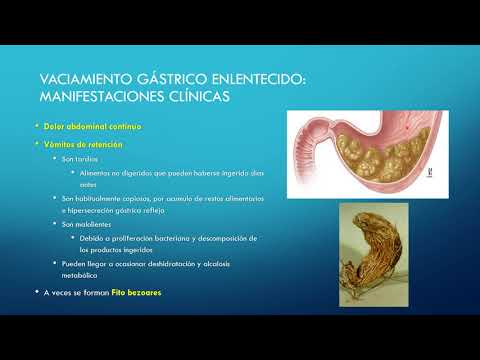 Video: Trastorno Intestinal (pérdida De Motilidad) En Perros