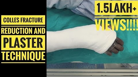 Colles Fracture Reduction and Plaster Technique