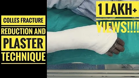 Colles Fracture Reduction and Plaster Technique