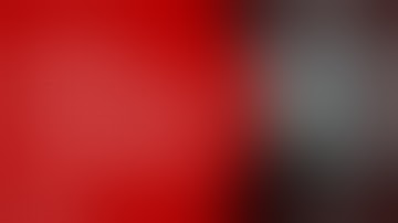 Combined Retrosigmoid, Middle Fossa, and Endonasal Approach to a Petroclival Chondrosarcoma