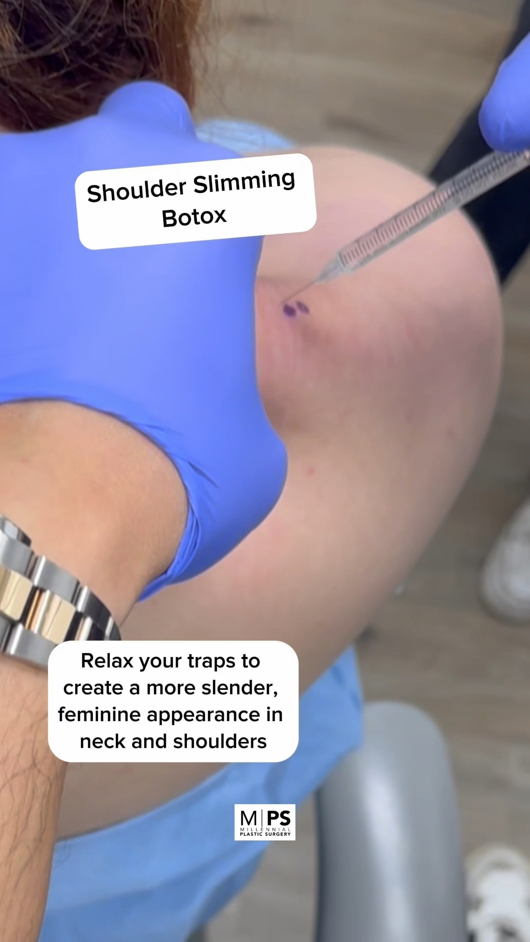 Traptox Injections Ease Muscle Pain In The Neck And Shoulders And Traptox Injections Ease Muscle Pain In The Neck And Shoulders And