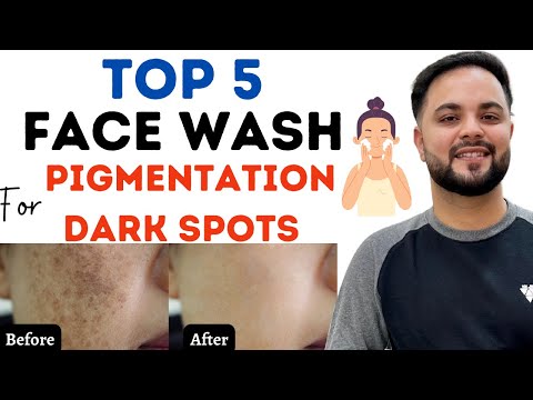 Top 5 Whitening Facewash To Remove Pigmentation x Dark Spots