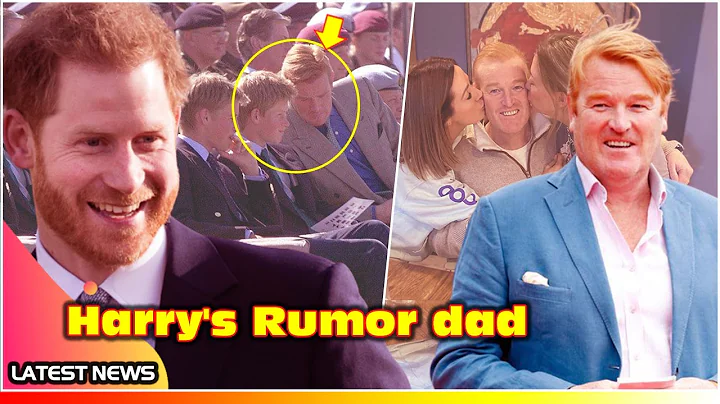 Prince Harry OVERJOYED as Mark Dyer, His Red Hair ...