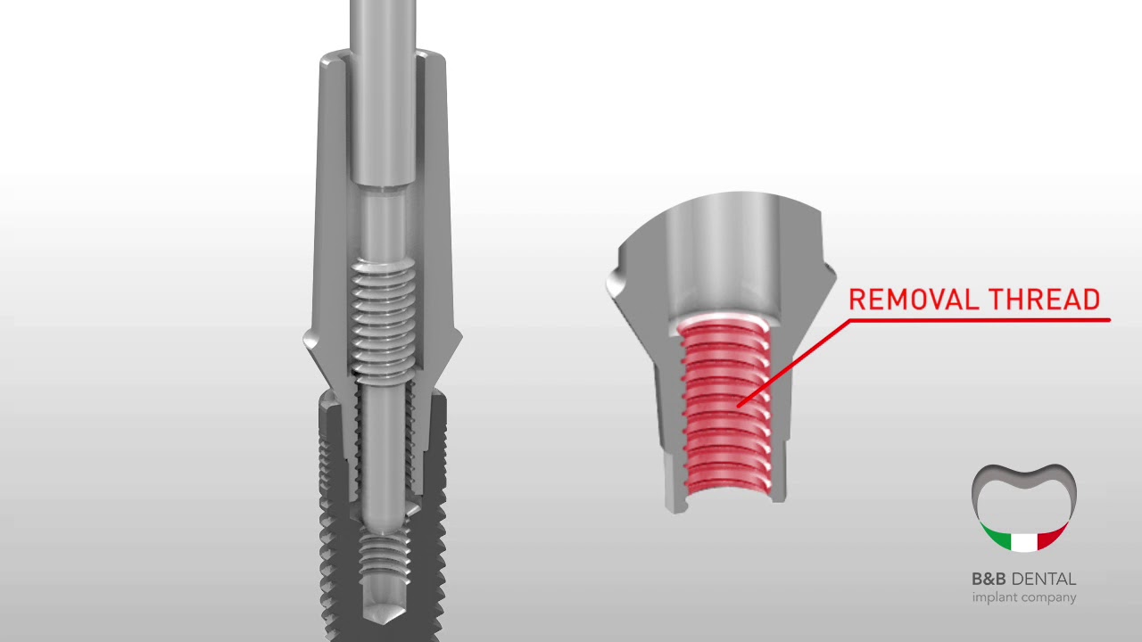 B&B Dental extraction tool YouTube