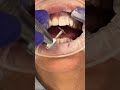 45 seconds of dentistry shorts