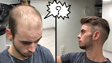 ¿Cómo puedo evitar que mi pelo encanezca?