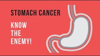 Stomach Cancer - Triggers, Symptoms, Treatments & Prevention