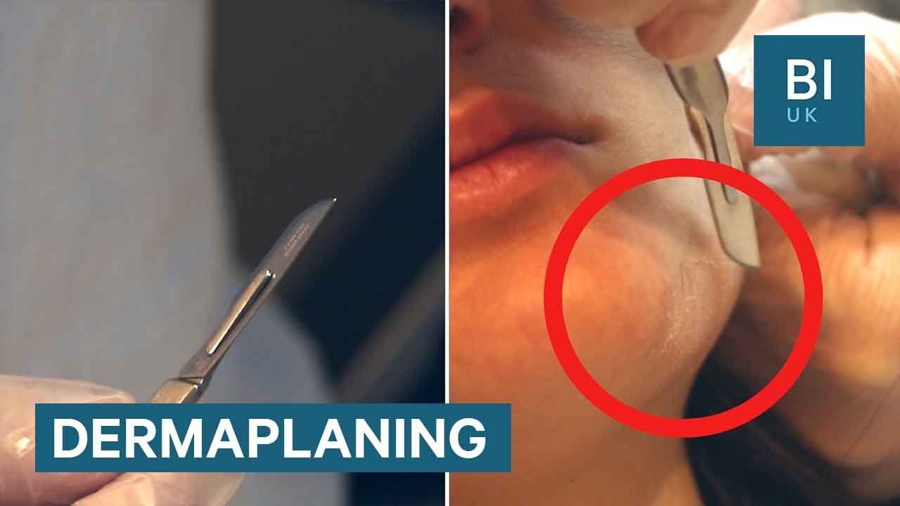 Dermaplaning scrapes dead skin off your face with a scalpel Dermaplaning scrapes dead skin off your face with a scalpel new pics Dermaplaning scrapes dead skin off your face with a scalpel Dermaplaning scrapes dead skin off your face with a scalpel new images