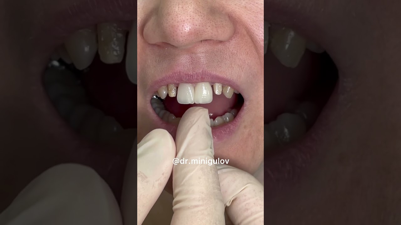 Прекрасная улыбка 😍