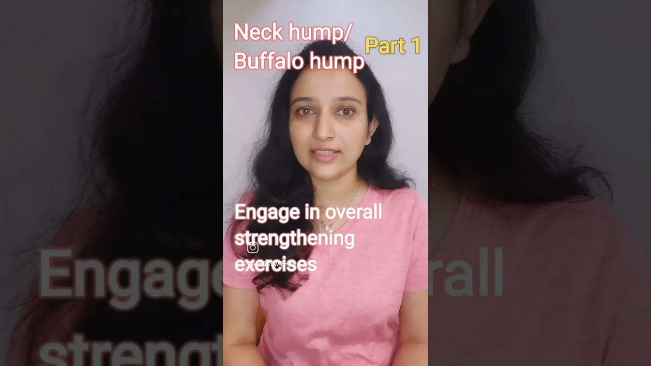 Neck Hump, How to Get Rid of Buffalo Hump, EP 23, Groove With Garima  Bhandari, Fit Tak