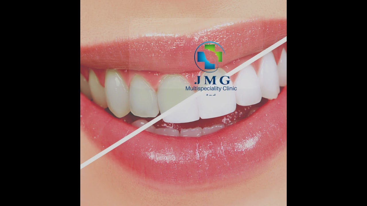 Free Dental check up