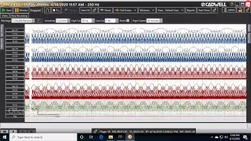 Step 9: How to use HL7 with Arc EEG software