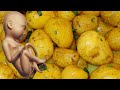 This Is What Happens To The Pregnant Woman And The Fetus When Eating Boiled Potatoes 