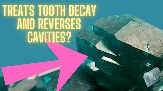How To Treat Tooth Decay And Reverse Cavities – The Simple Solution!