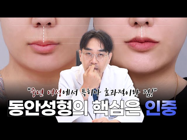 동안 얼굴을 만드는 마지막 퍼즐 "인중" / 입술·인중 교정✨