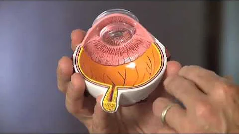 What are Flashes And Floaters? | SightMD