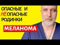 Когда ваши родинки опасны? Что такое меланома кожи и как самостоятельно обнаружить ее у себя