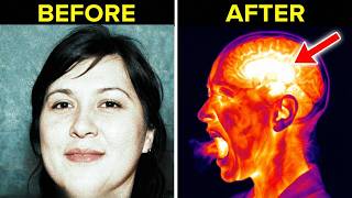 She Mixed Cough Syrup With Her Medication. Her Muscles Dissolved.