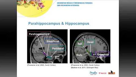 Michael Bodnar - Neurobiological markers of remiss...