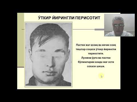 Video: Тиш одонтопластика деген эмне?