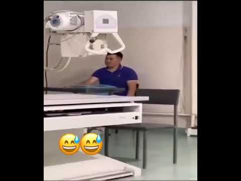 Самый лучший день приколы | сломал руку #shorts
