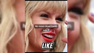Taylor Swift's New Smile (Veneers) That No One Noticed...