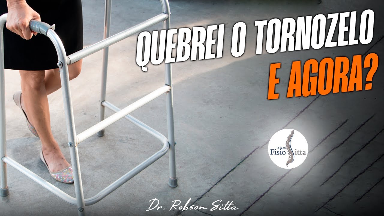 FRATURA BIMALEOLAR do TORNOZELO - RECUPERAÇÃO APÓS CIRURGIA COM FISIOTERAPIA Dr. Robson Sitta