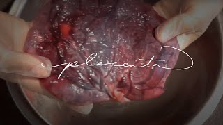 At Home Placenta Encapsulation | WARNING: Graphic Content | Tahiti Rey