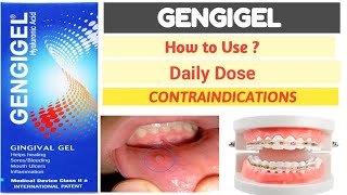GENGIGEL Hyaluronic Acid Gel | Gingivitis, Ulcers & Gum Care