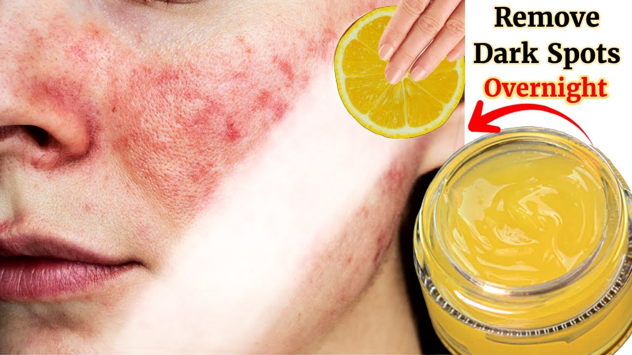 Vitamin C Cream Skin Whitening lemon cream Treat Pigmentation