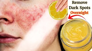 Vitamin C Cream | Skin Whitening lemon cream | Treat Pigmentation Melasma Acne Marks & Scars