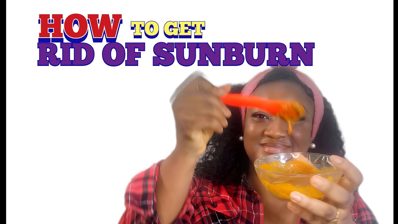HOW TO GET RID OF SUNBURN HOMEMADE SUNBURN TREATMENT YouTube