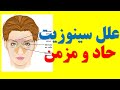 علل سینوزیت و عوامل بوجود آورنده سینوزیت حاد و مزمن